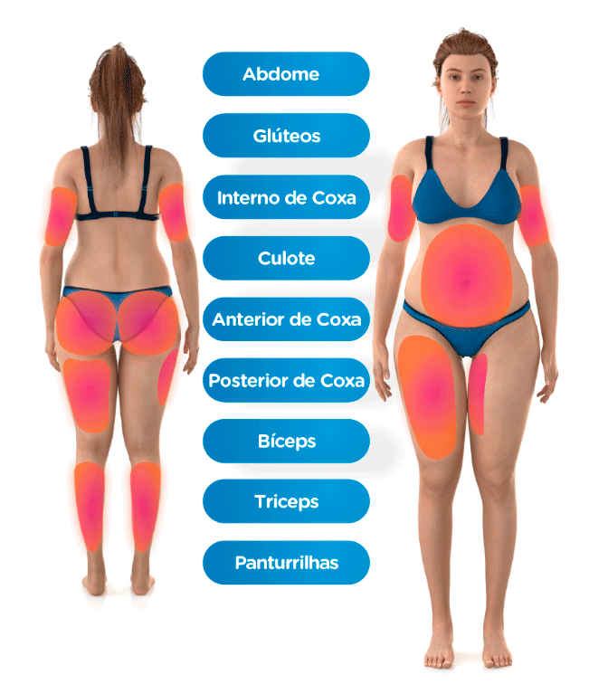 Desenho com as áreas do corpo que podem ser tratadas com EMSculpt Neo